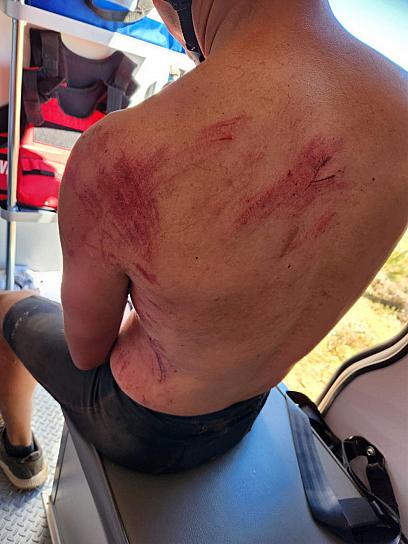 CICLISTA DE PINOS SUFRE CAÍDA