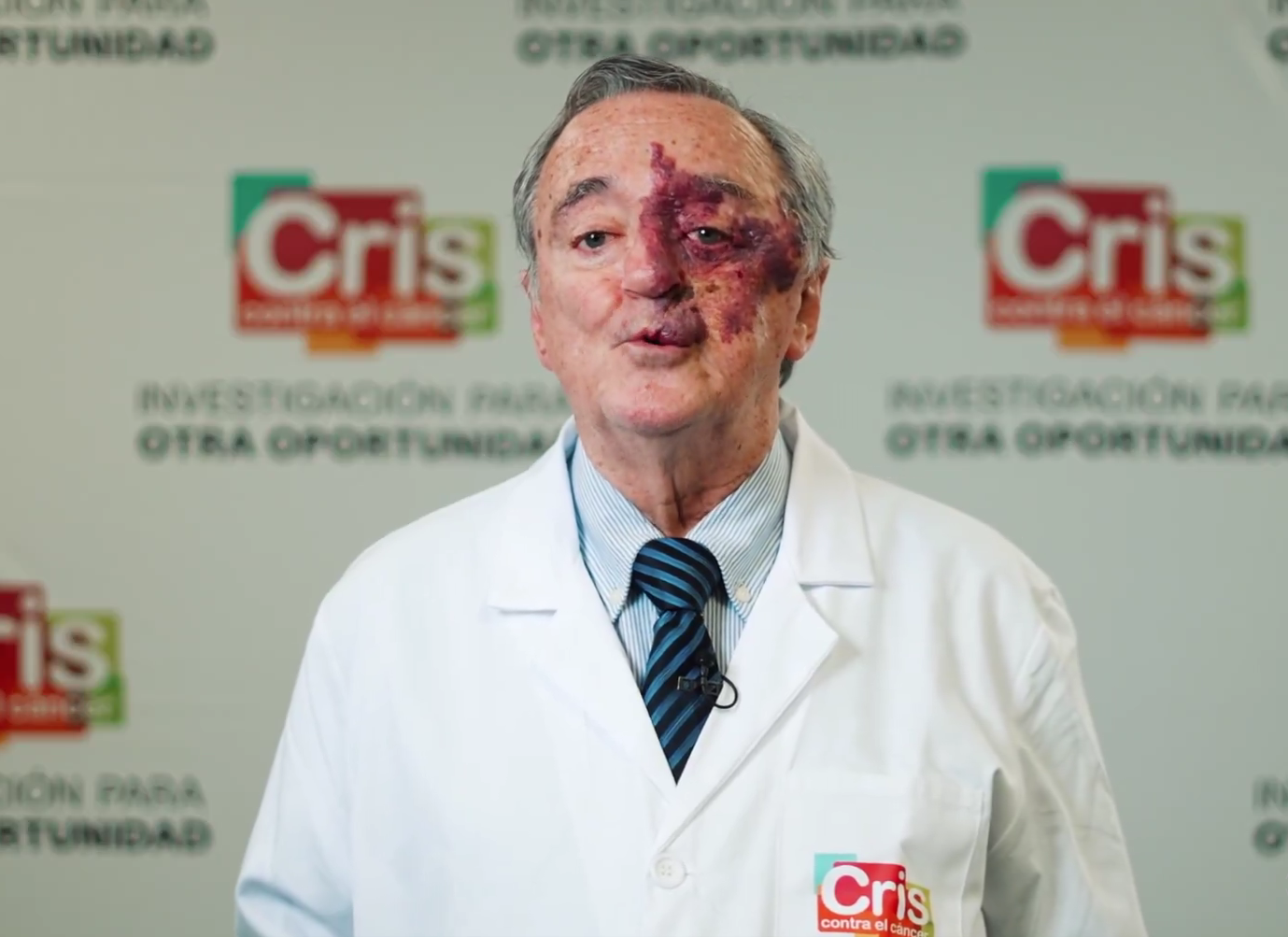 AVANCE HISTÓRICO CONTRA EL CÁNCER DE PÁNCREAS: ELIMINAN TUMORES EN MODELOS ANIMALES