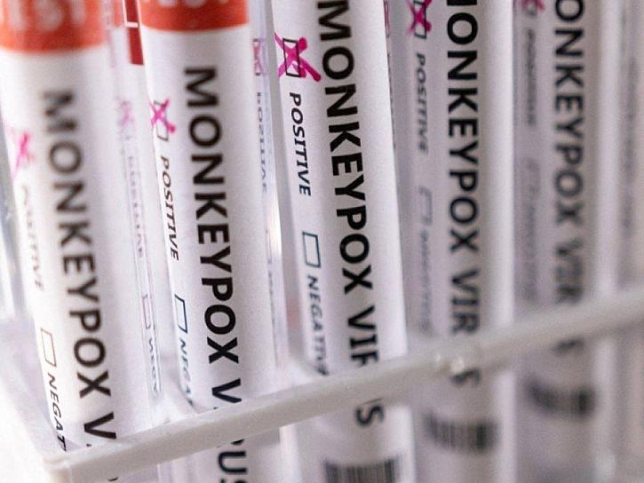 CONFIRMAN CINCO CASOS POSITIVOS DE VIRUELA DEL MONO EN JALISCO 