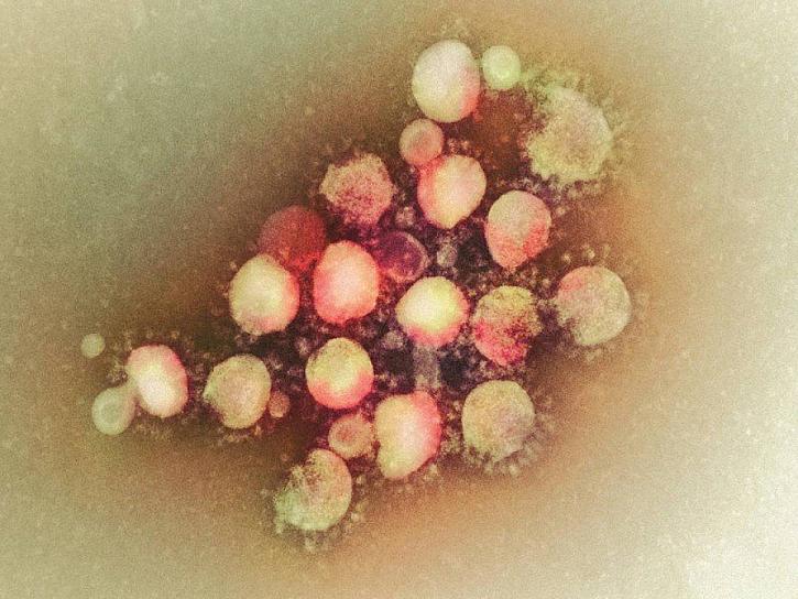  EL CORONAVIRUS MERS REAPARECE EN QATAR