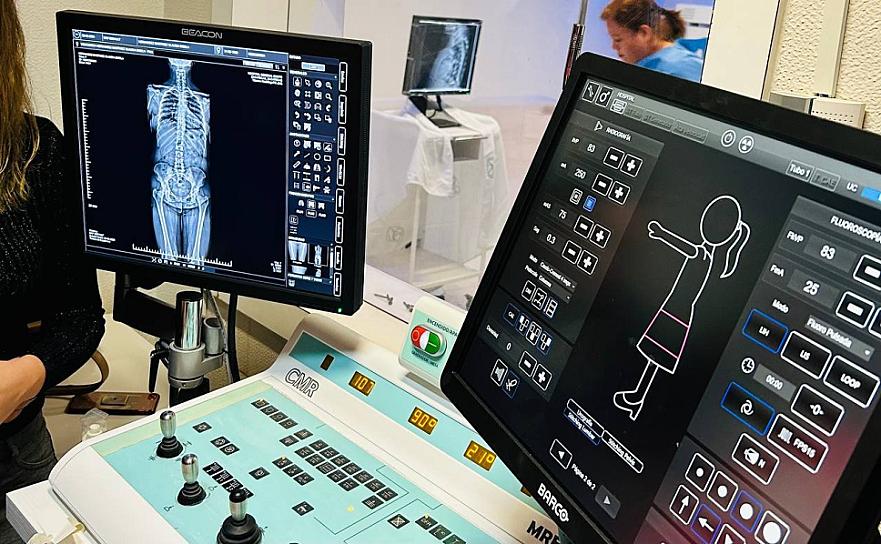 ESTRENA ISSSTE NUEVO EQUIPO DE RAYOS X DE ALTA TECNOLOGÍA 