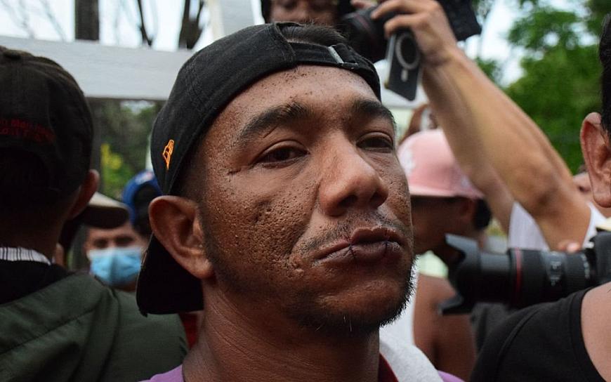 MIGRANTES RECIBEN CON PROTESTAS A AMLO EN TAPACHULA CHIAPAS 