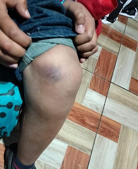 NIÑO SOLICITA AYUDA TRAS SER GOLPEADO POR SU PADRE 