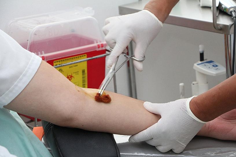 17 DE ABRIL, DÍA MUNDIAL DE LA HEMOFILIA