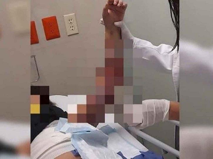 QUEMAN A NIÑA DE 11 AÑOS EN ALBERGUE 