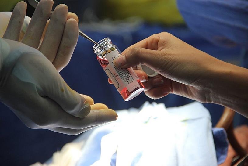 REALIZA IMSS MIL 267 TRASPLANTES DE ÓRGANOS ESTE AÑO