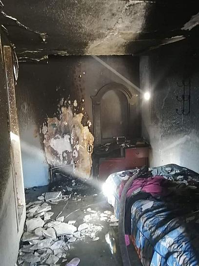 SUFRE MUJER DE LA TERCERA EDAD QUEMADURAS DE SEGUNDO GRADO POR INCENDIO 